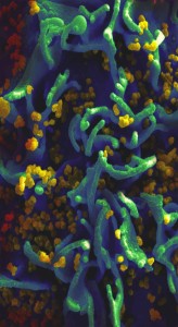 ICI-AIDSac2013-cov1-w